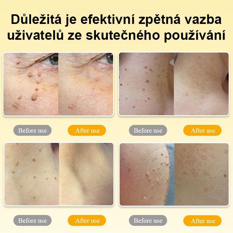 BOOMOON Sprej na péči o bradavice s včelím jedem