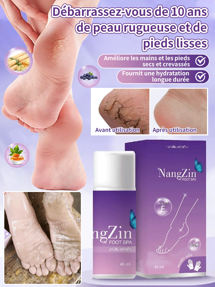【Élimination des callosités de dix ans】Sérum exfoliant pour les pieds