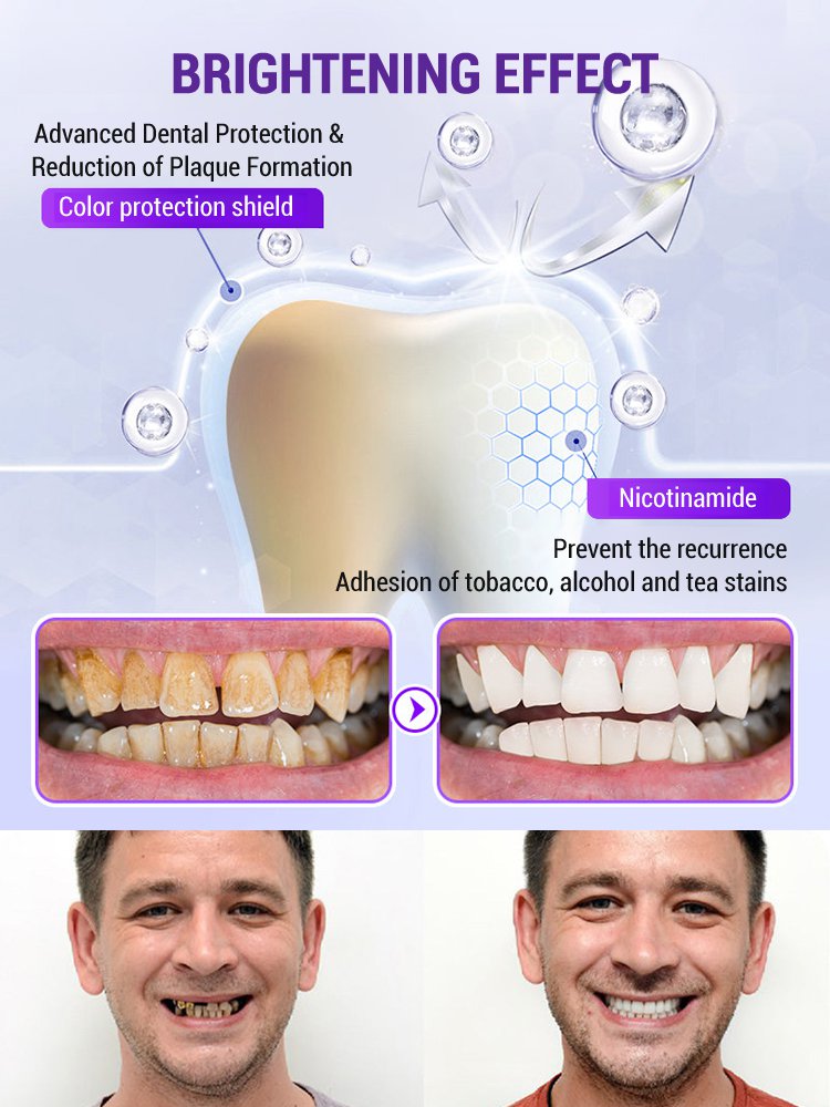 【Periodontal Health Restoration】Purple Mineral Tooth Powder for Tooth Restoration