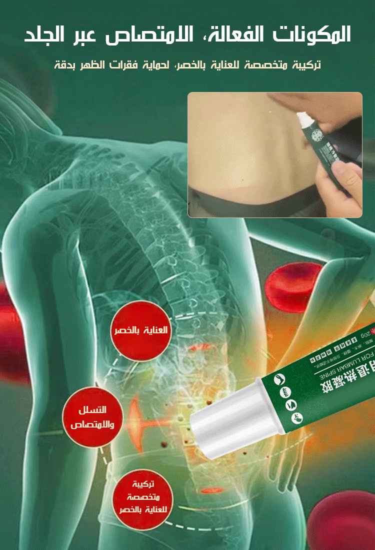 جل طبي لتخفيف الآلام لمنطقة فقرات الظهر