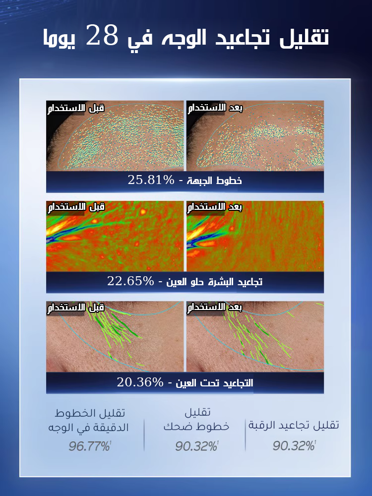 【موصى به بشدة من المدونين】كريم A313 بالريتينول لتنشيط البشرة