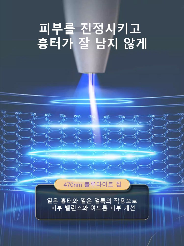 레이저 무통 사마귀 제거 펜