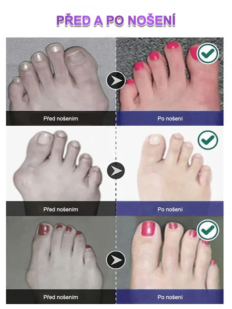 Protiskluzové jóga ponožky s pěti prsty