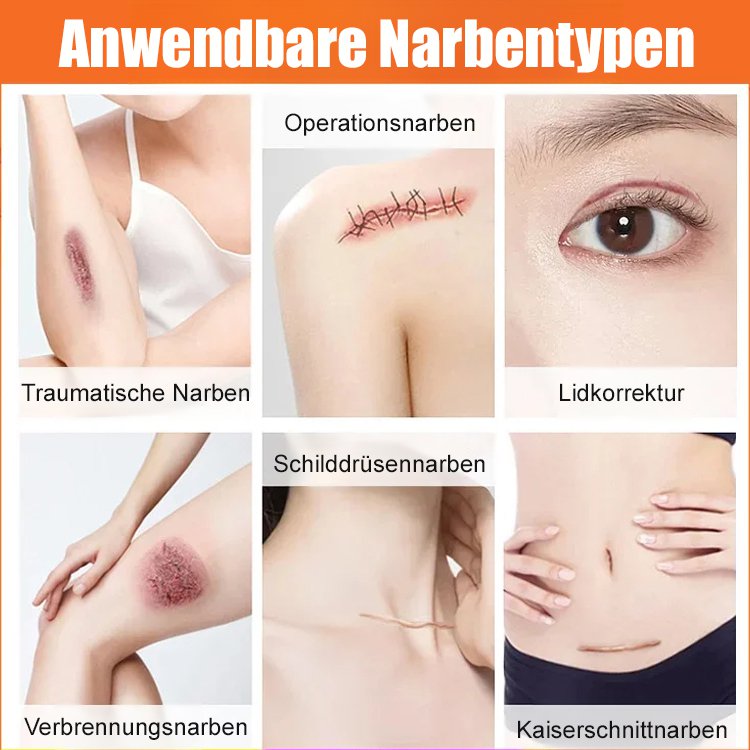 Hochwirksames Narbenreparaturgel