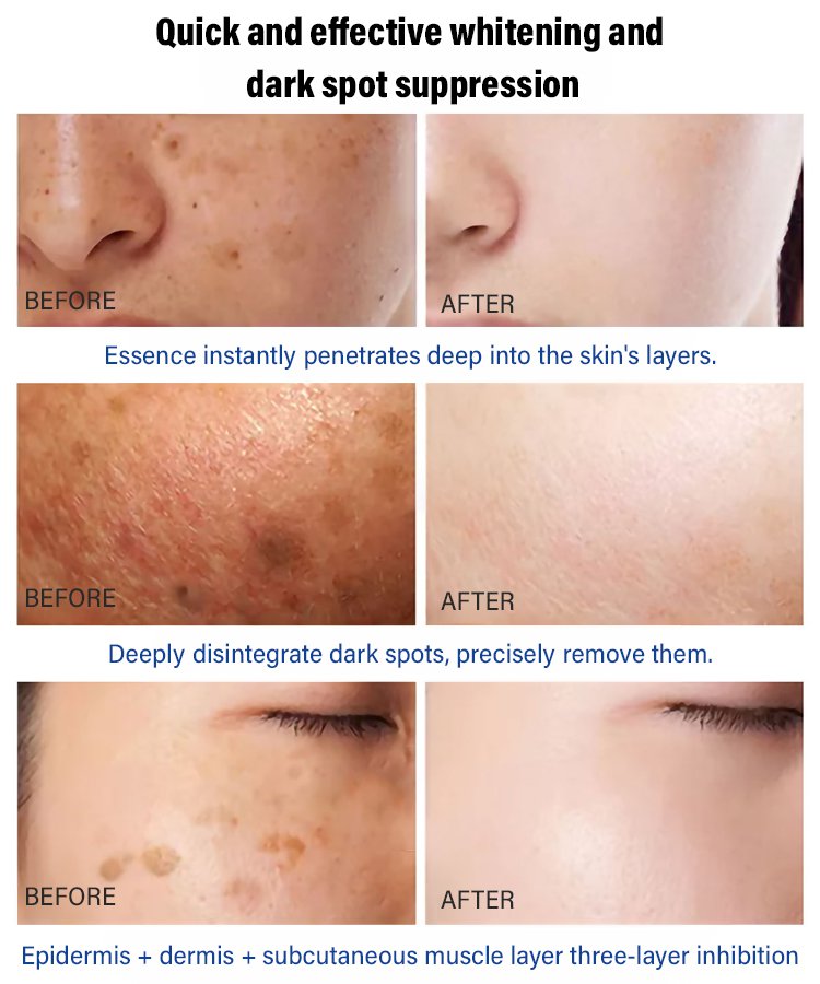 Freckle-Banishing Serum for Face: Repair and Cleanse Dark Spots