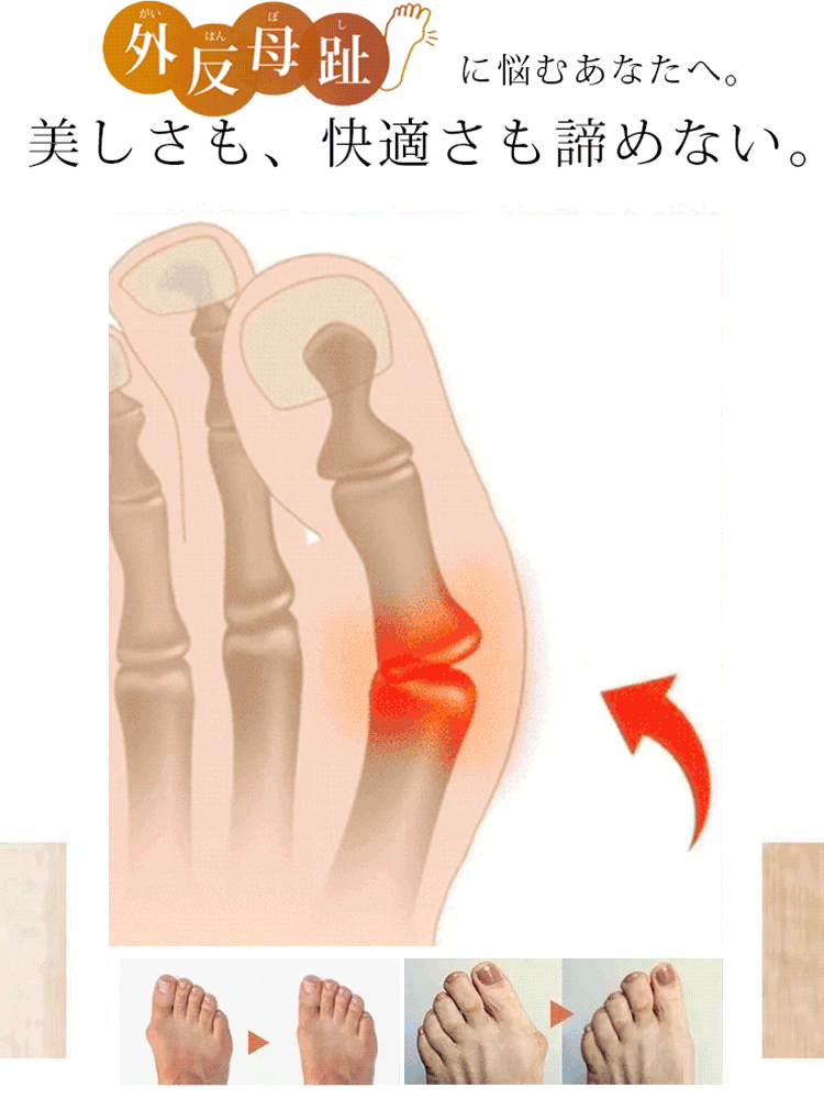 レディース本革オープントゥ透かし彫りサンダル