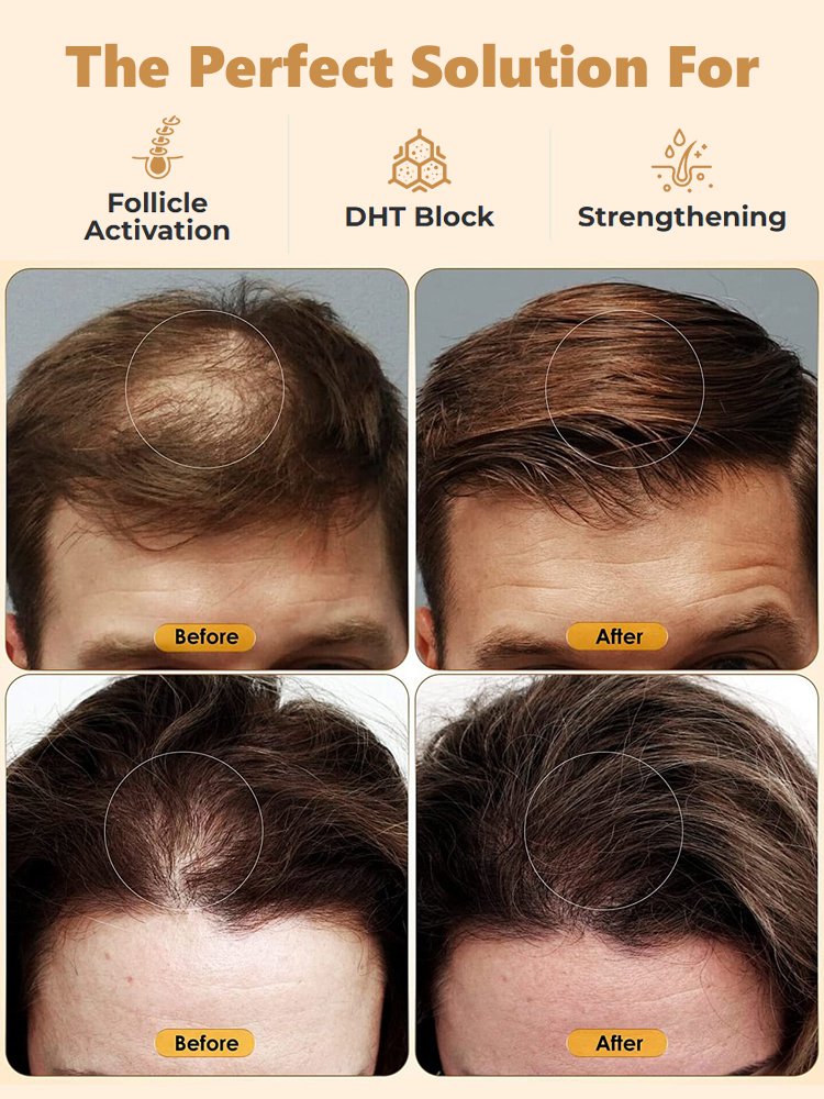 [Deep Nourishment] Hair Growth Activating Shampoo