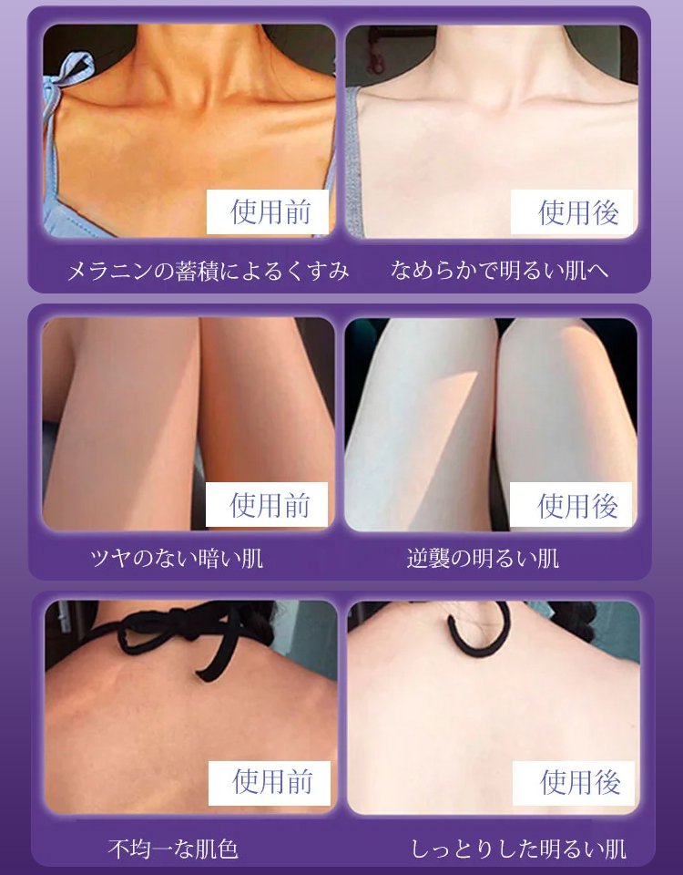 美白ボディクリーム