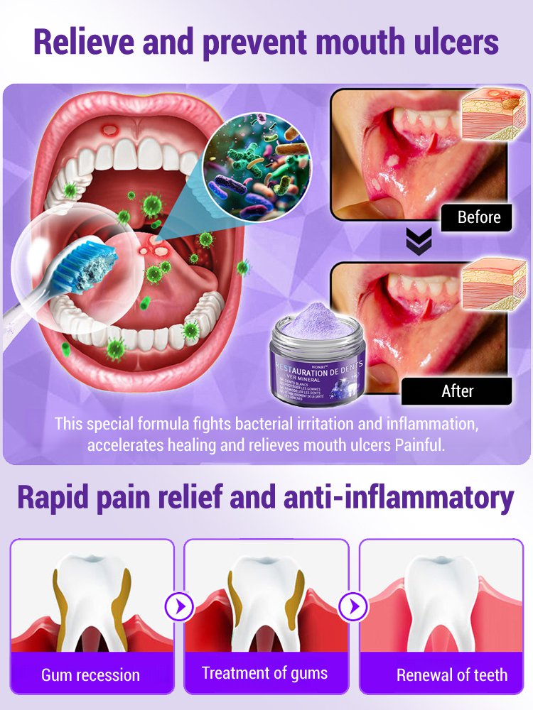 【Periodontal Health Restoration】Purple Mineral Tooth Powder for Tooth Restoration