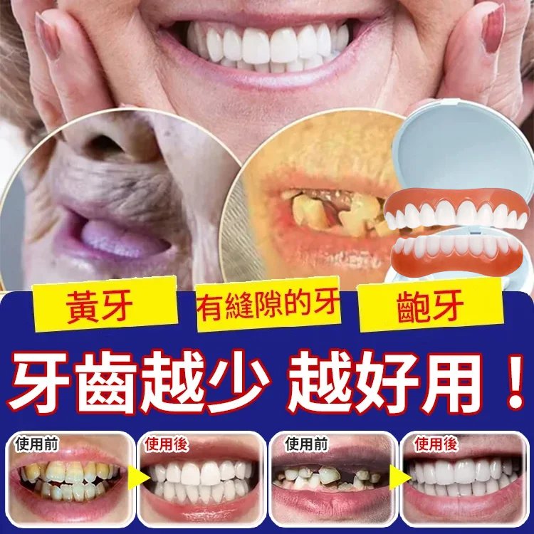 舒適美牙假牙