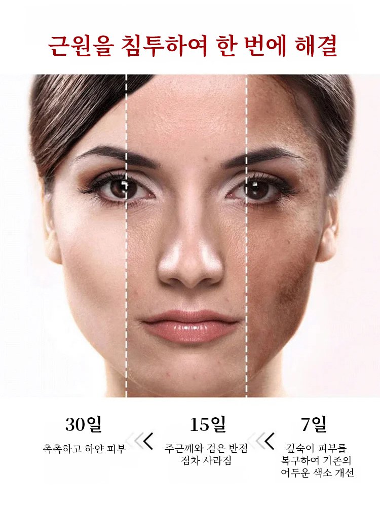 【깊은 클렌징, 무자극】민감성 피부 사용 가능 미백 필오프 마스크