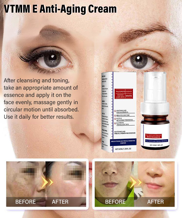 Freckle-Banishing Serum for Face: Repair and Cleanse Dark Spots
