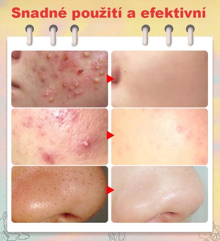 X23051506E-Vysoce přesné a vysoce tvrdé svorky článků