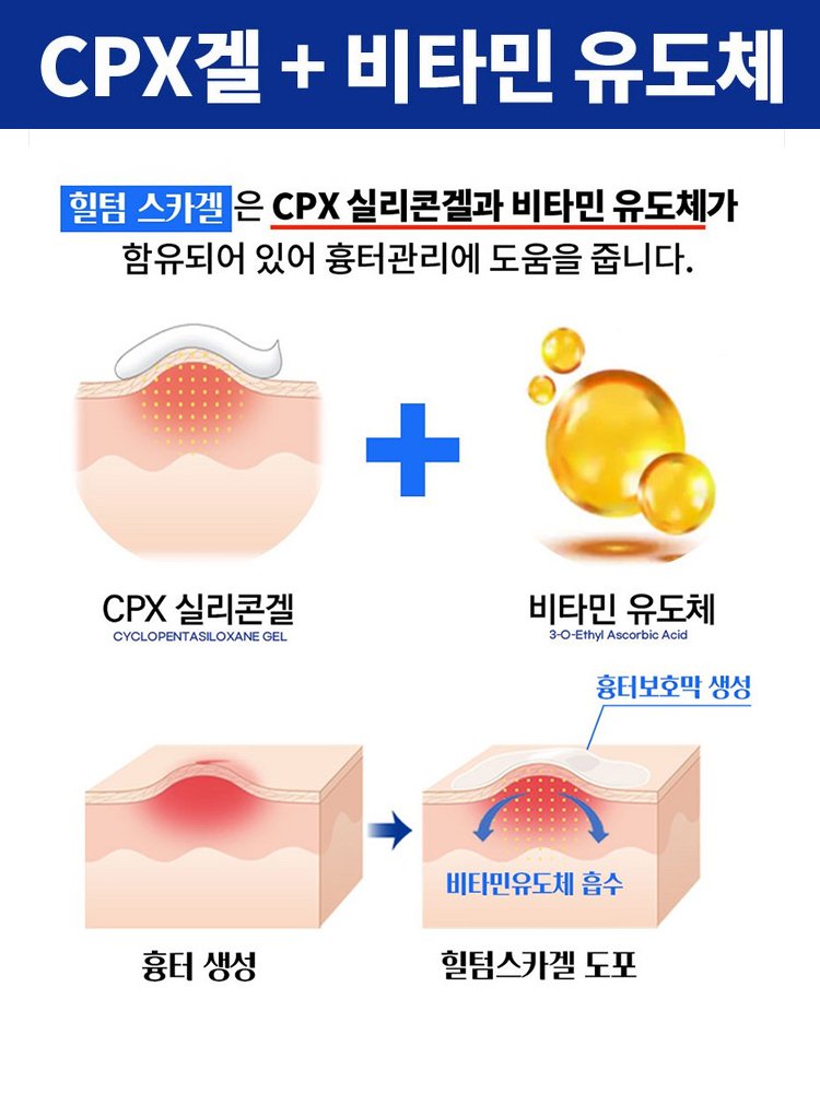 의료용 실리콘 흉터 젤