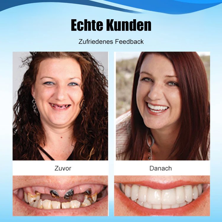 Zahnprothesenset mit Silikonauskleidung