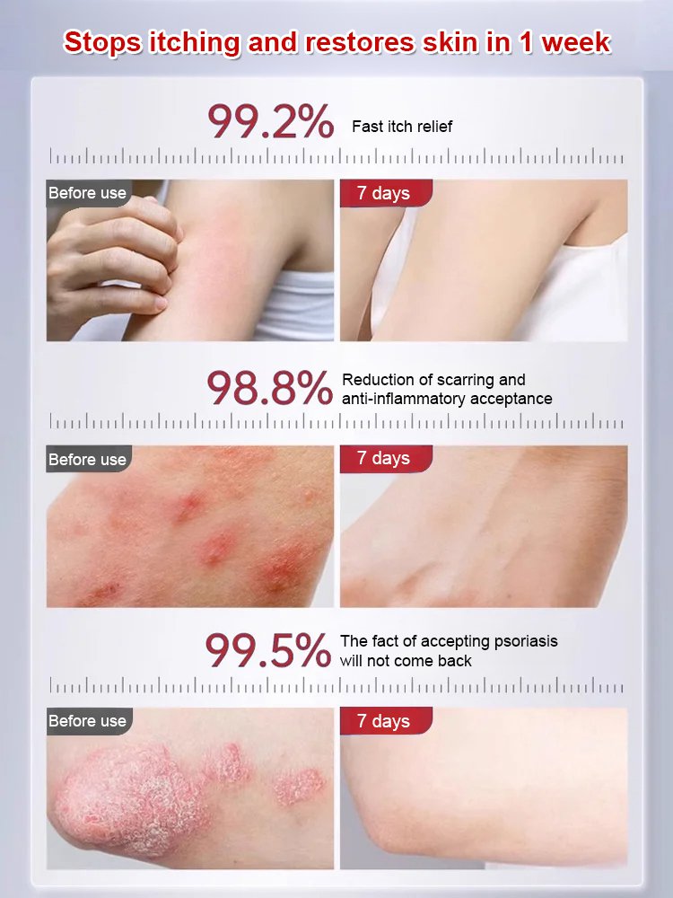 [Specializing in stubborn dermatitis] Skin soothing care cream
