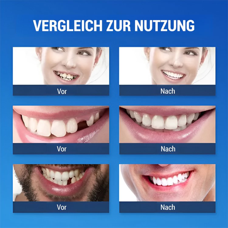 Simulation von aufhellenden Silikon-Zahnprothesen