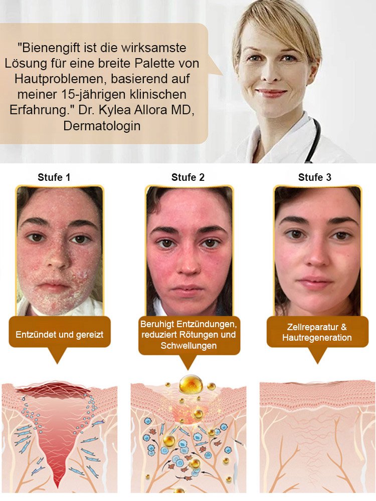 Bienengift Körperpflegesalbe