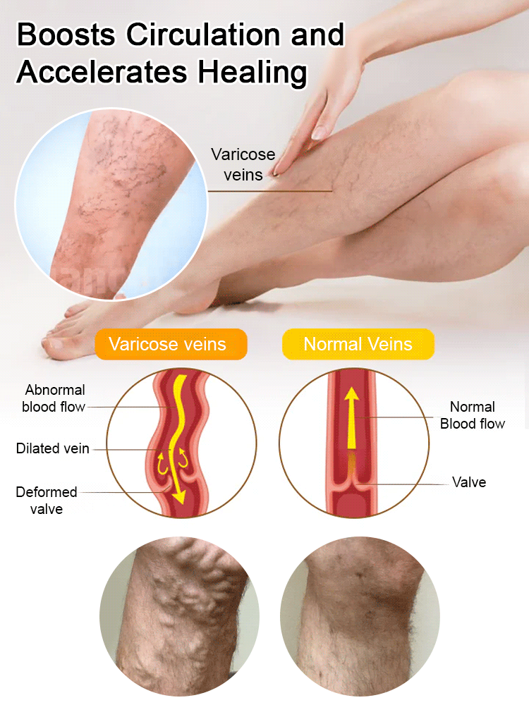 Bee venom skincare cream