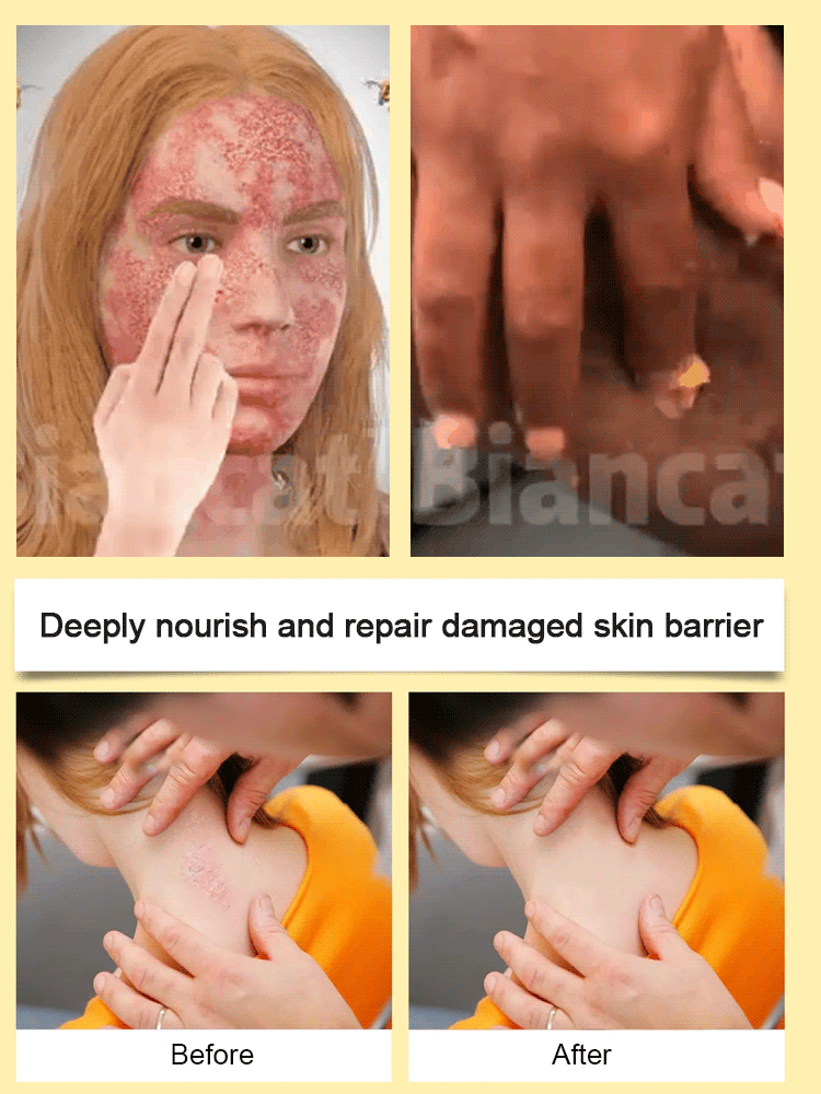 Bee venom skincare cream