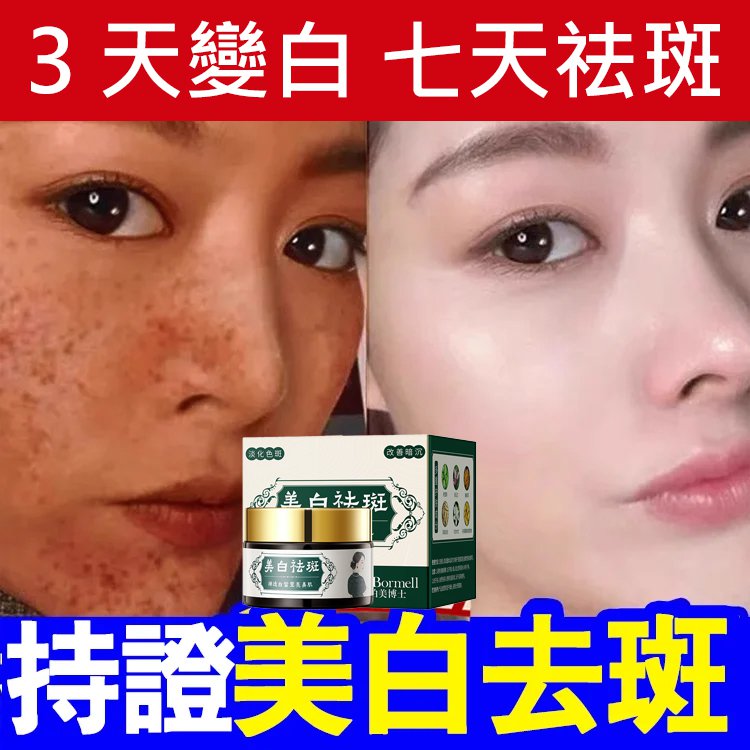 【3天變白，七天祛斑】草本美白祛斑霜