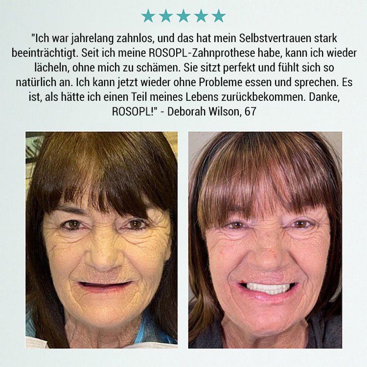 【3-in-1】Zahnersatz-Verschönerungsset