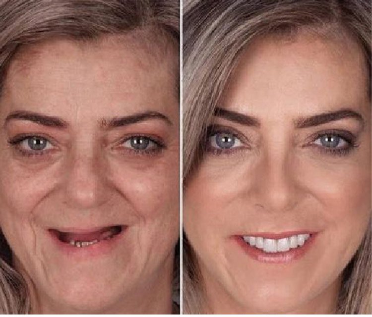Human Food Grade Thermoplastic Denture Adhesive 30 Untitled-1_12.jpg