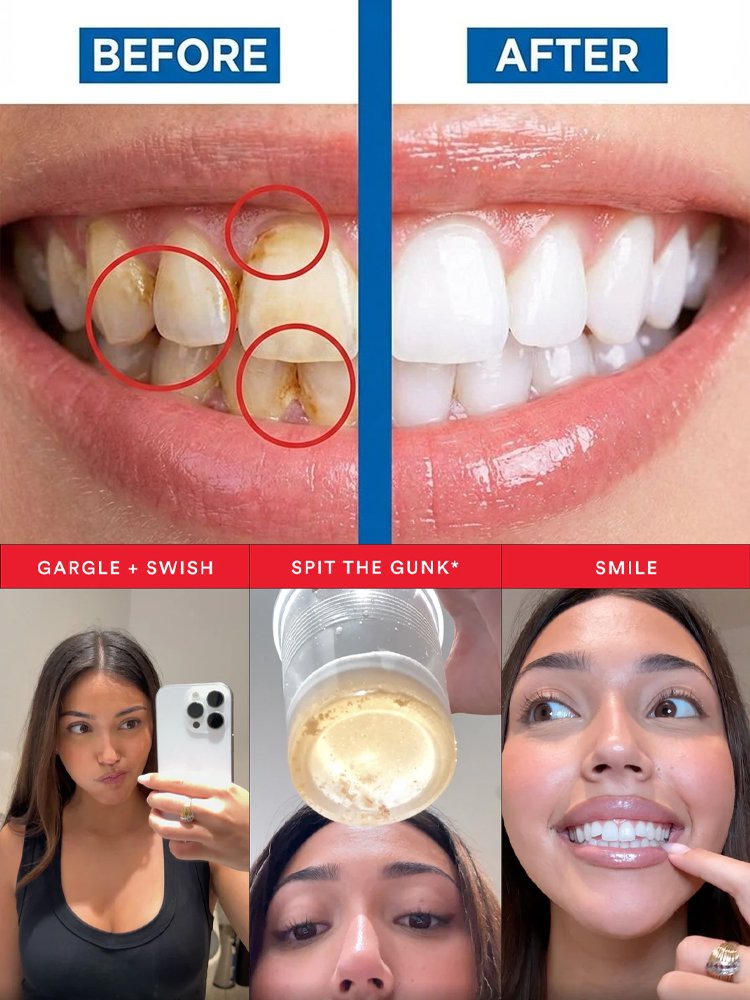 [Keep Smiling] Deep Cleansing and Fragrance-Leaving Mouthwash