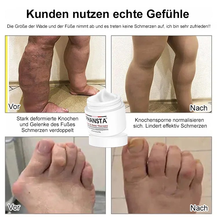 Gelenkknochen-Reparaturcreme