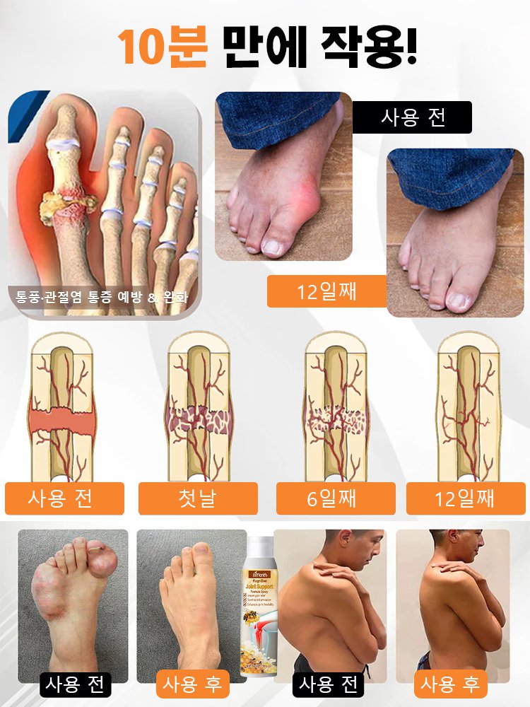 【붓기·통증 케어】 관절 관리 스프레이