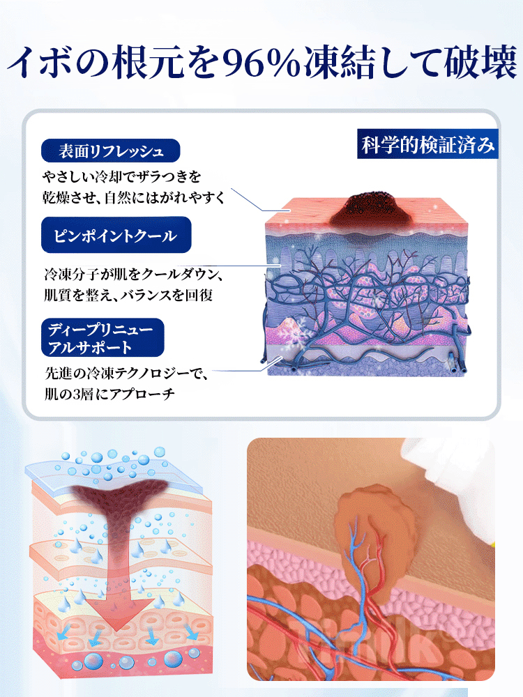LOVILDS™ アイスクール肌修復スプレー