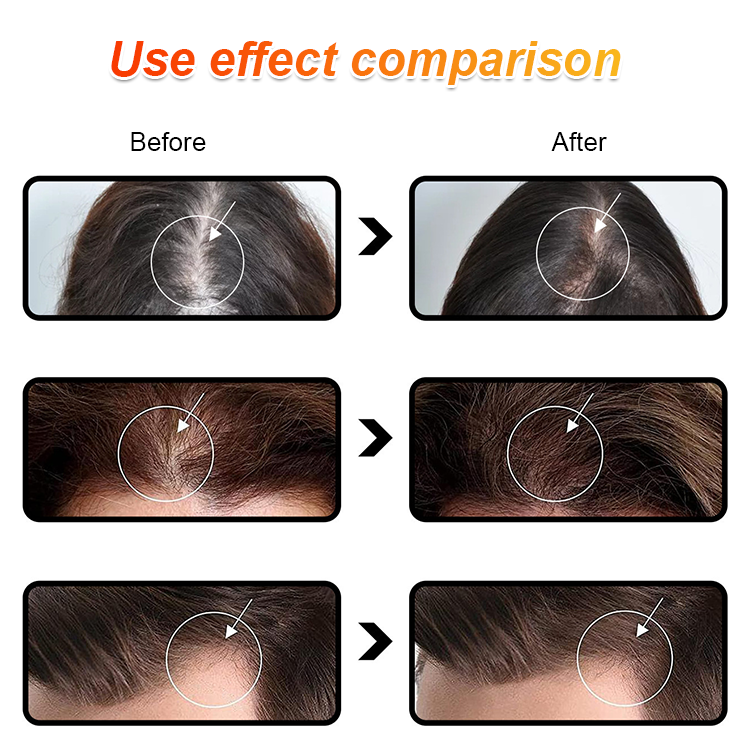 Batana Oil for Strengthening Hair and Preventing Hair Loss