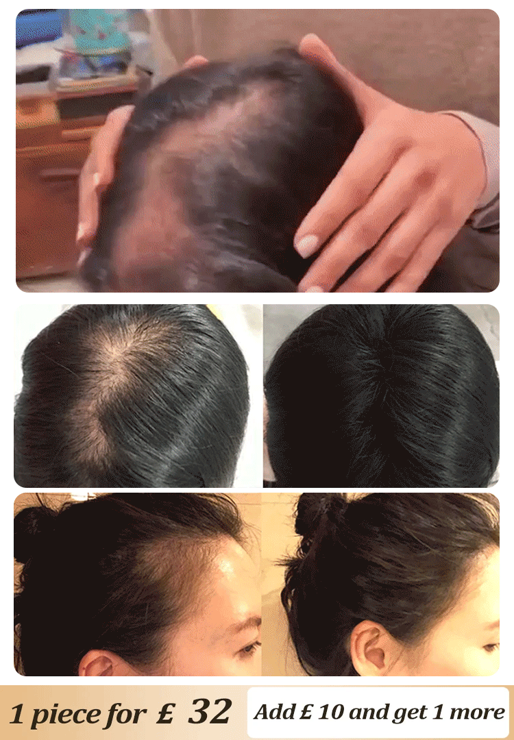 Explosive Ginger Anti-Hair Loss Shampoo