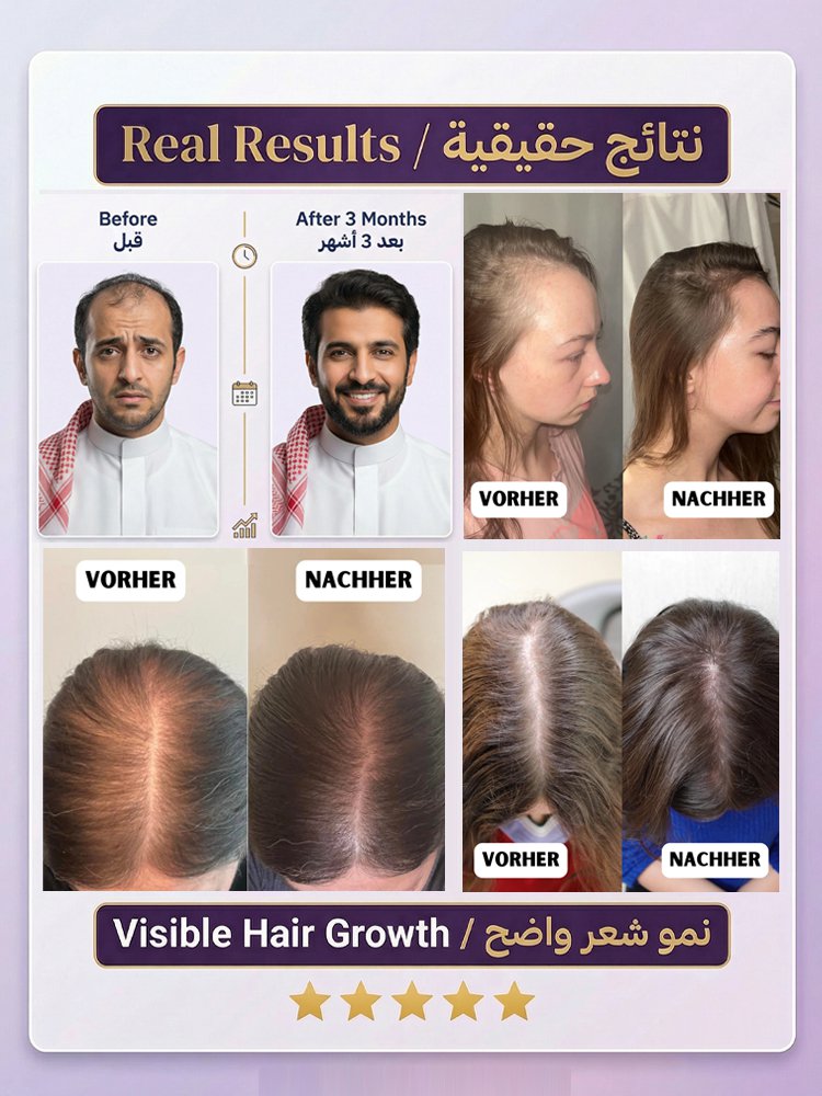 مشط ليزر لإنبات وتدليك الشعر