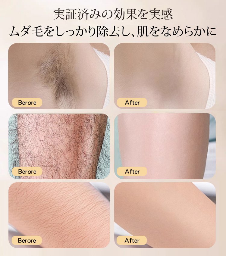 【男女兼用】マイルド補修除毛クリーム