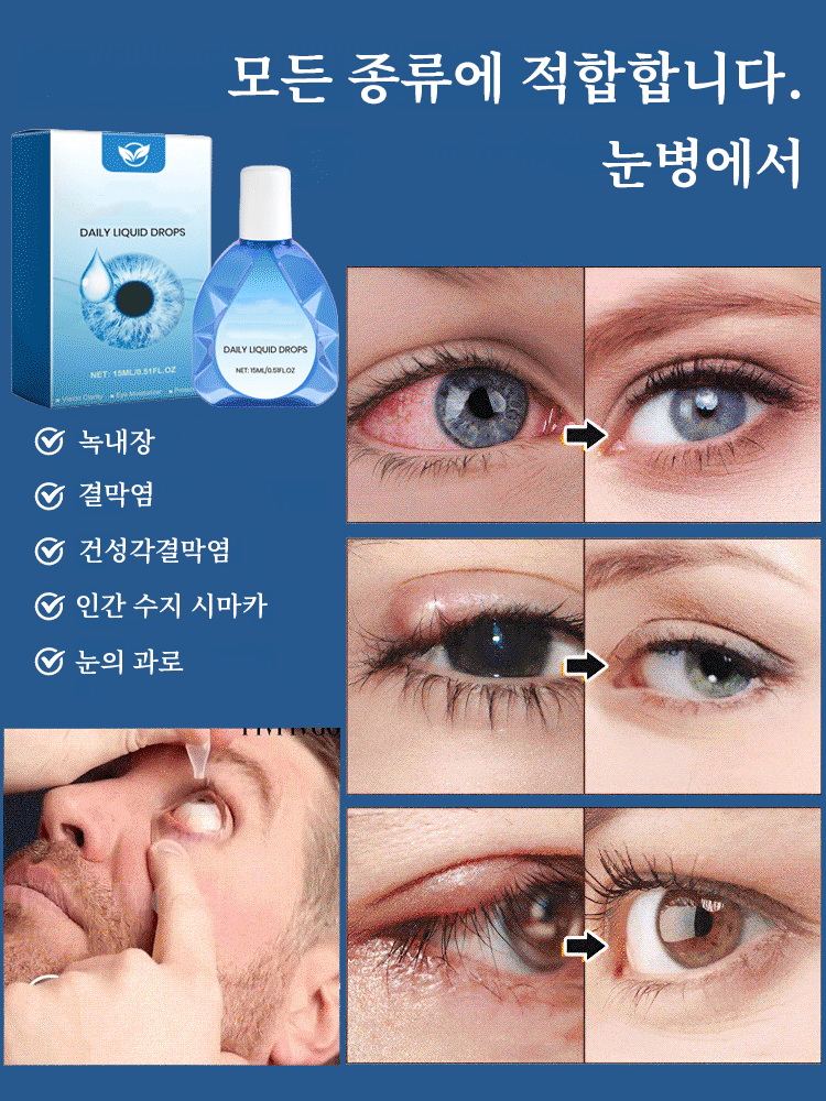 시력 교정 및 보습 점안액