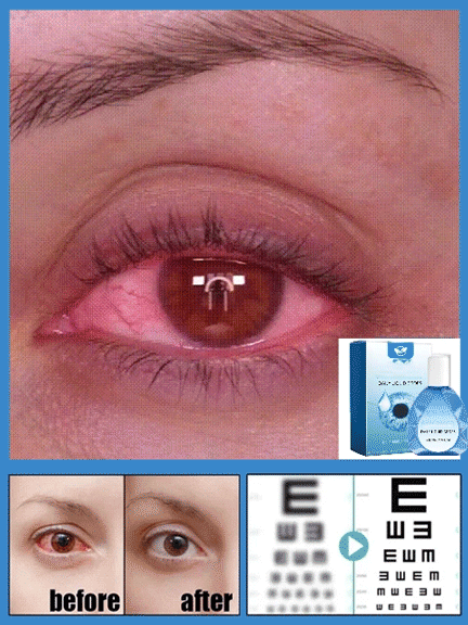 시력 교정 및 보습 점안액