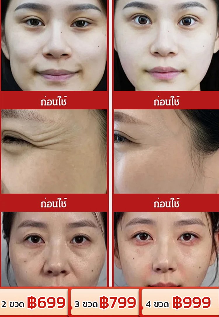 【สำหรับผู้หญิงวัย 30+】แคปซูลแอสตาแซนธินเพื่อผิวขาวและลดริ้วรอย