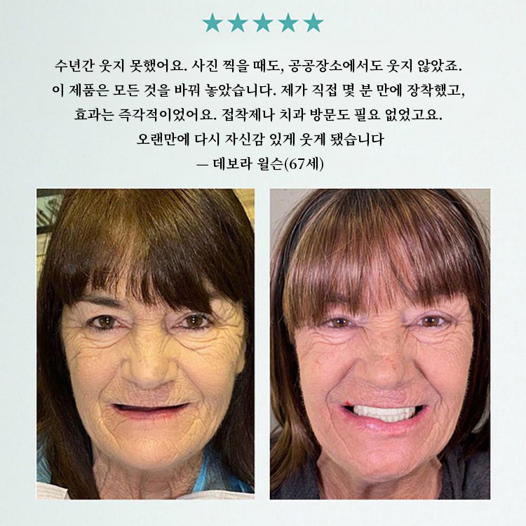 【3-in-1】미백 틀니 세트 7일 무료 체험！