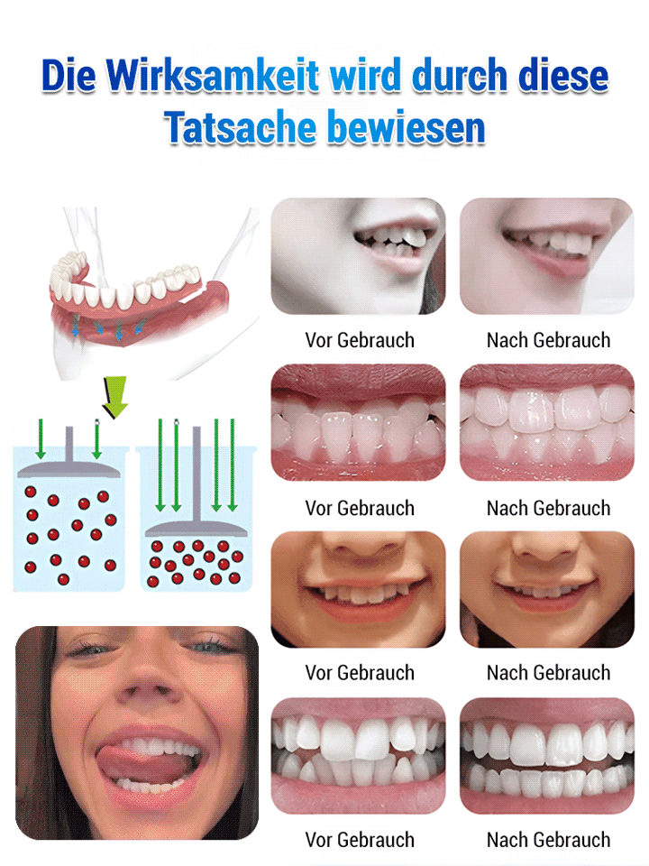 Medizinisches Patent: Schönheitsprothesen-Set