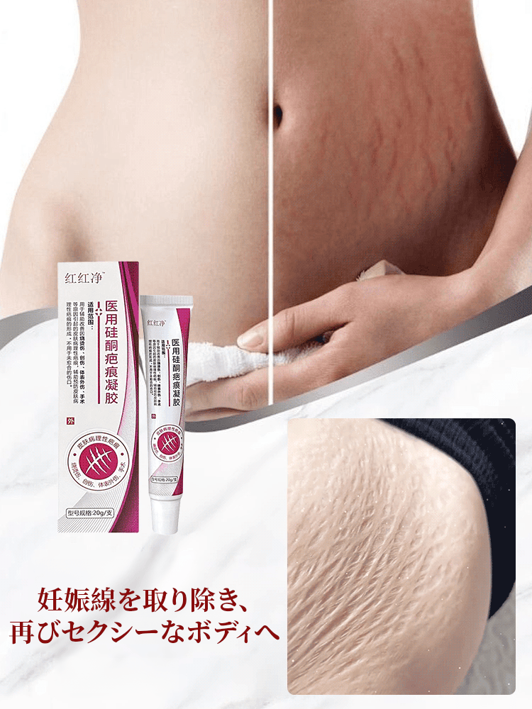 医療用シリコーン瘢痕ジェル