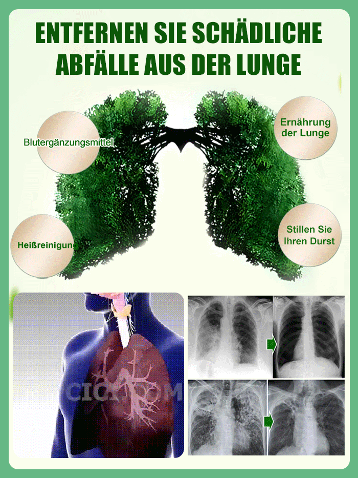 【Trockenheitsresistenter Giftkönig】Platin-Diamant-Grüne Prinzessin Topfpflanze mit großen Blättern