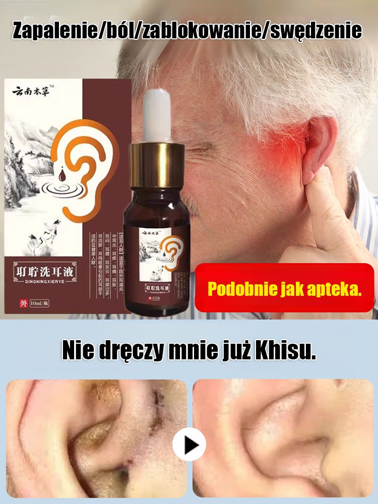 【Skoncentruj się na zdrowiu uszu】 Yunnan Materia Medica Cerumen Ear Wash