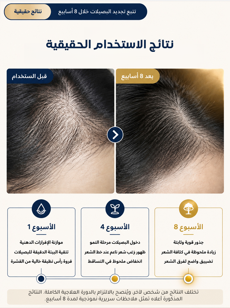 سيروم فروة الرأس لمنع تساقط الشعر وتعزيز نمو الشعر