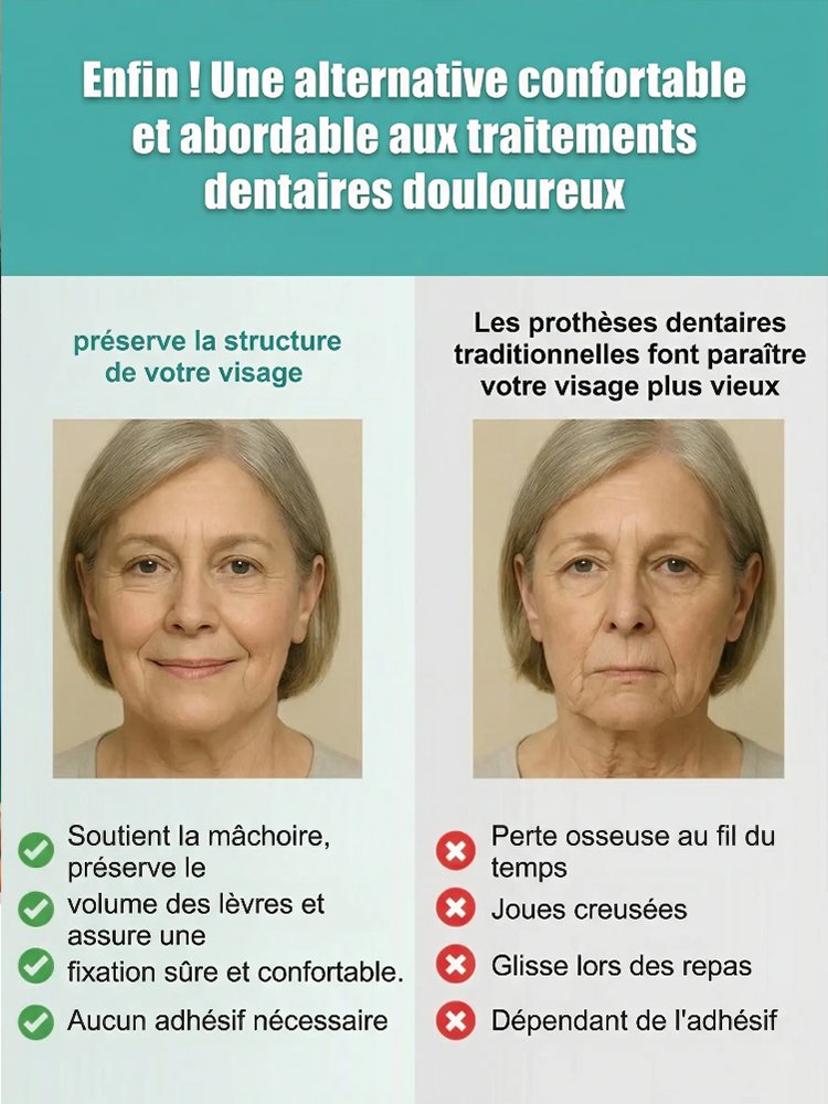 Kit de décoration pour prothèses dentaires à ajustement confortable