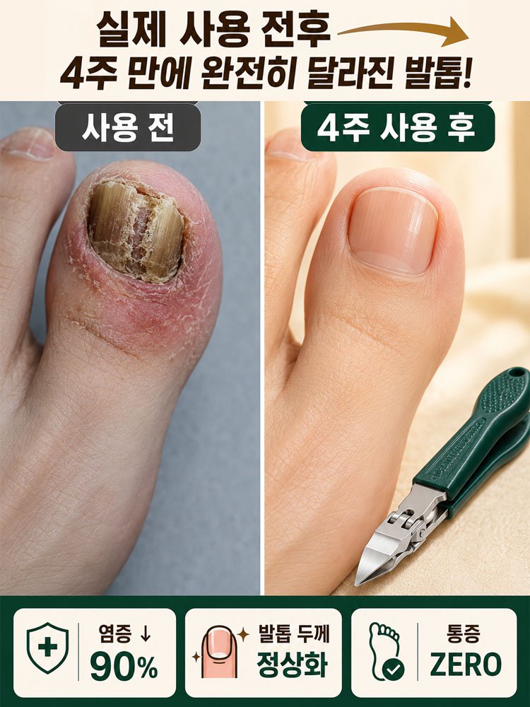 【장마철 대비】내성 발톱 전용 네일 클리퍼