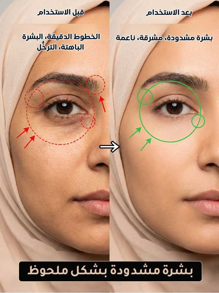 كريم عيون بالكافيار الفاخر لمكافحة التجاعيد وشدّ البشرة