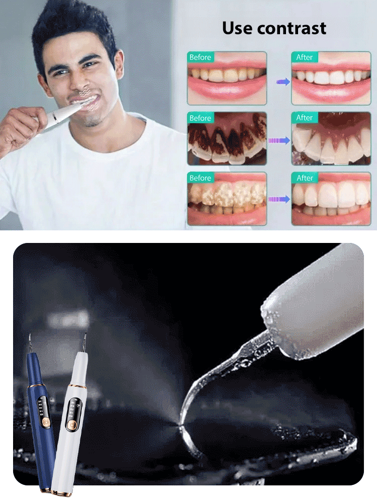 Ultraviolet sterilization ultrasonic toothbrush
