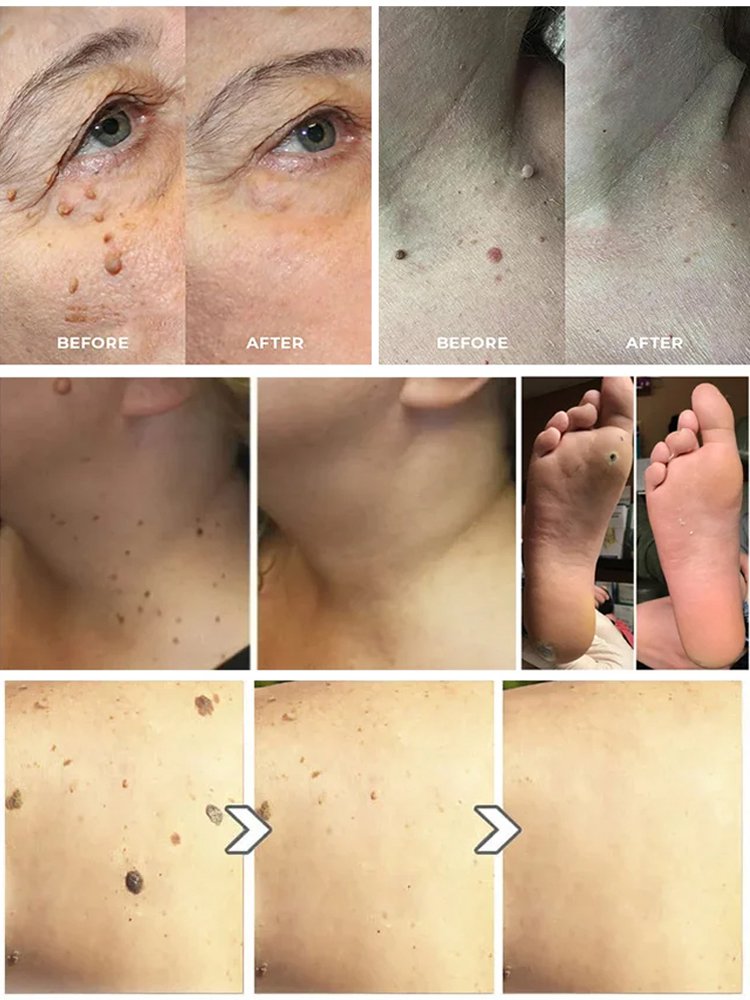 흑미 멀티 리뉴얼 크림