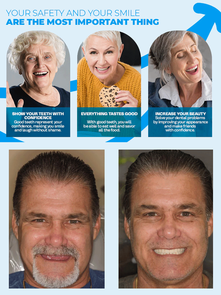 100% Realistic and Comfortable Dentures | Painless, No Glue Required丨Unisex